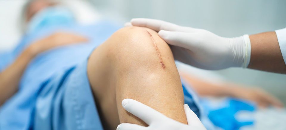 بعد از کشیدن بخیه چه باید کرد؟