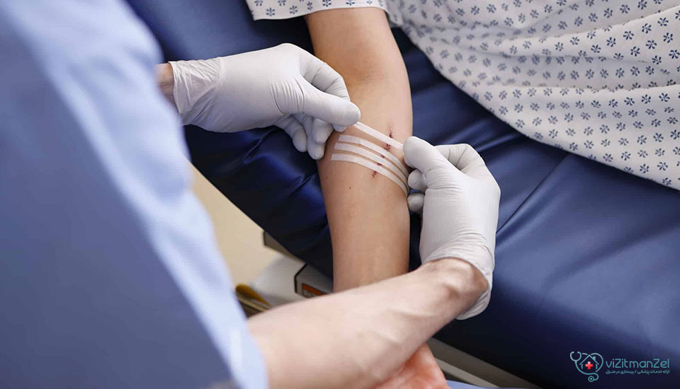 بعد از کشیدن بخیه چه باید کرد؟ آشنایی با نکات لازم در مورد بخیه