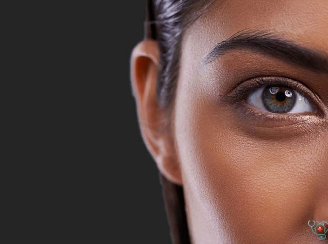 بوتاکس چشم گربه ای؛ نحوه تزریق، عوارض و ماندگاری آن