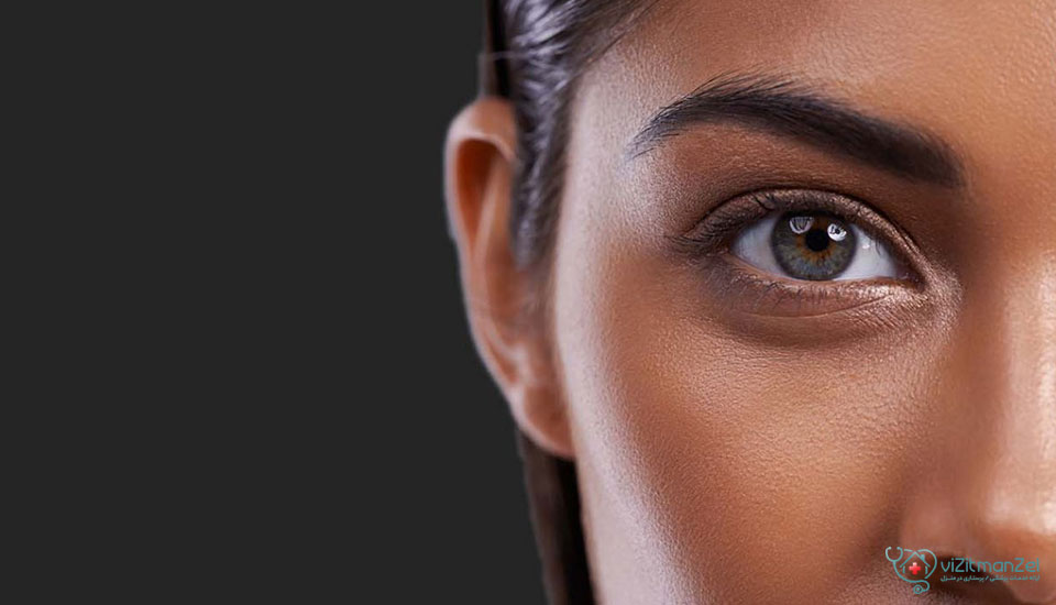 بوتاکس چشم گربه ای؛ نحوه تزریق، عوارض و ماندگاری آن