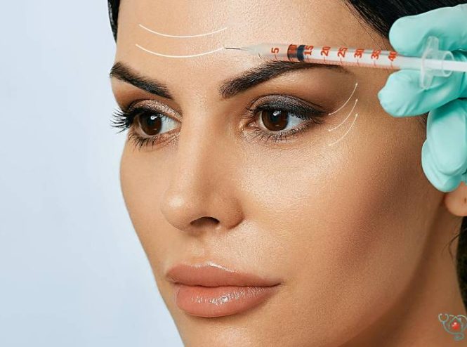 بوتاکس در درمان خطوط پیشانی و دور چشم باعث کاهش چین و چروک‌ها و جوانسازی پوست صورت می‌شود.