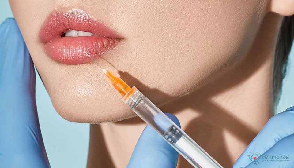 ژل لب مدل قلبی با فرم‌دهی طبیعی و جذاب، انتخابی محبوب برای زیبایی چهره