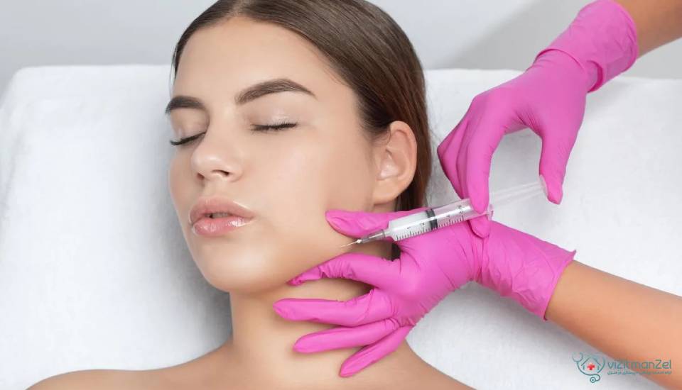 مزایای تزریق ژل چانه و افزایش جذابیت صورت