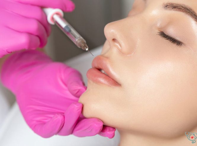 لب روسی خط دار روشی برای فرم‌دهی عمودی لب با خطوط مشخص و ساختار فانتزی