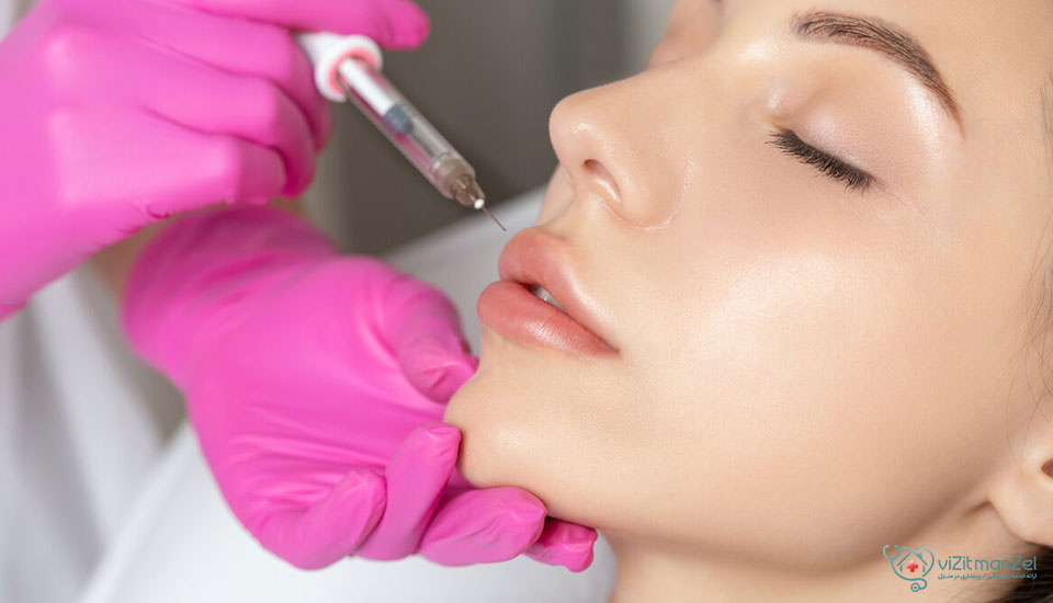 لب روسی خط دار روشی برای فرم‌دهی عمودی لب با خطوط مشخص و ساختار فانتزی