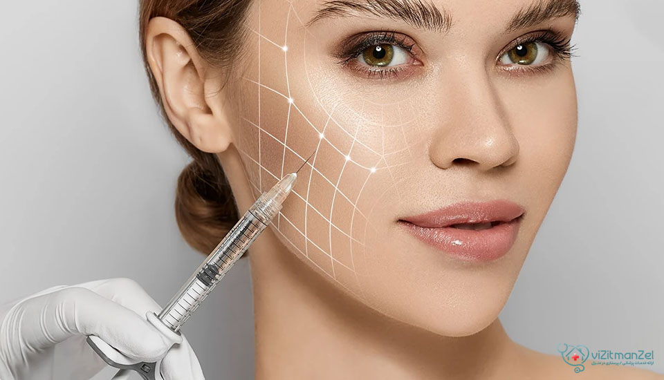 تزریق کات گونه برای برجسته‌سازی طبیعی گونه‌ها و ایجاد زاویه در صورت