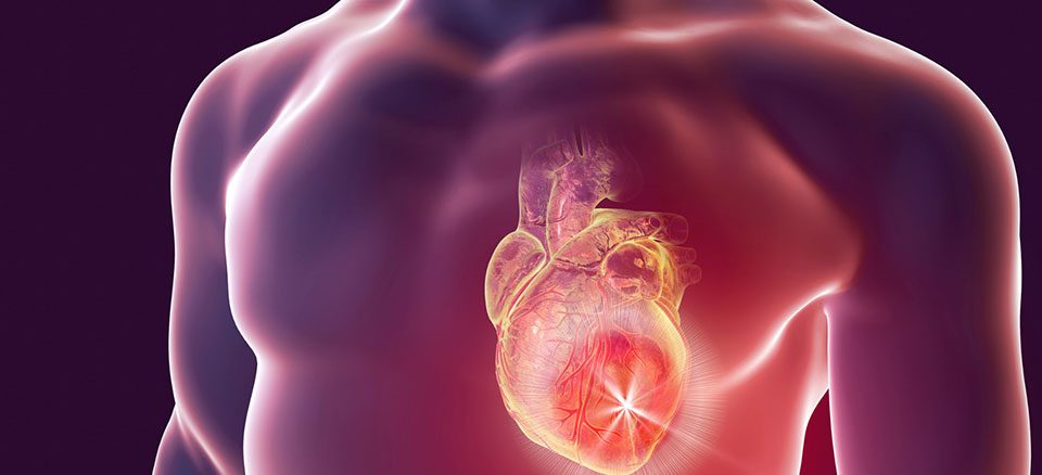 عوارض سکته قلبی خاموش شامل نارسایی قلبی، آریتمی و افزایش خطر سکته مجدد