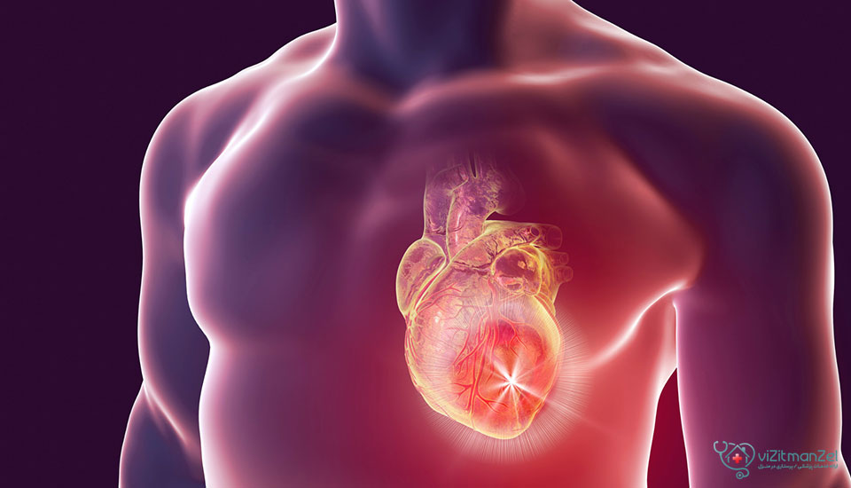 عوارض سکته قلبی خاموش شامل نارسایی قلبی، آریتمی و افزایش خطر سکته مجدد