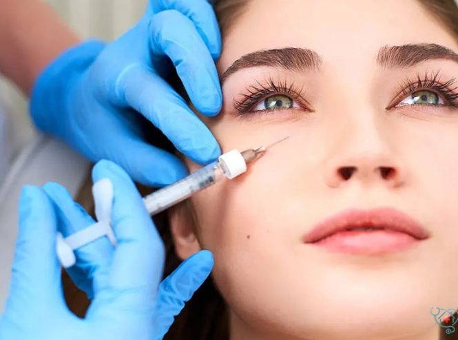 روش‌های تزریق فیلر زیر چشم و مراحل آن